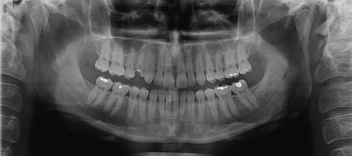 radiologie panoramique