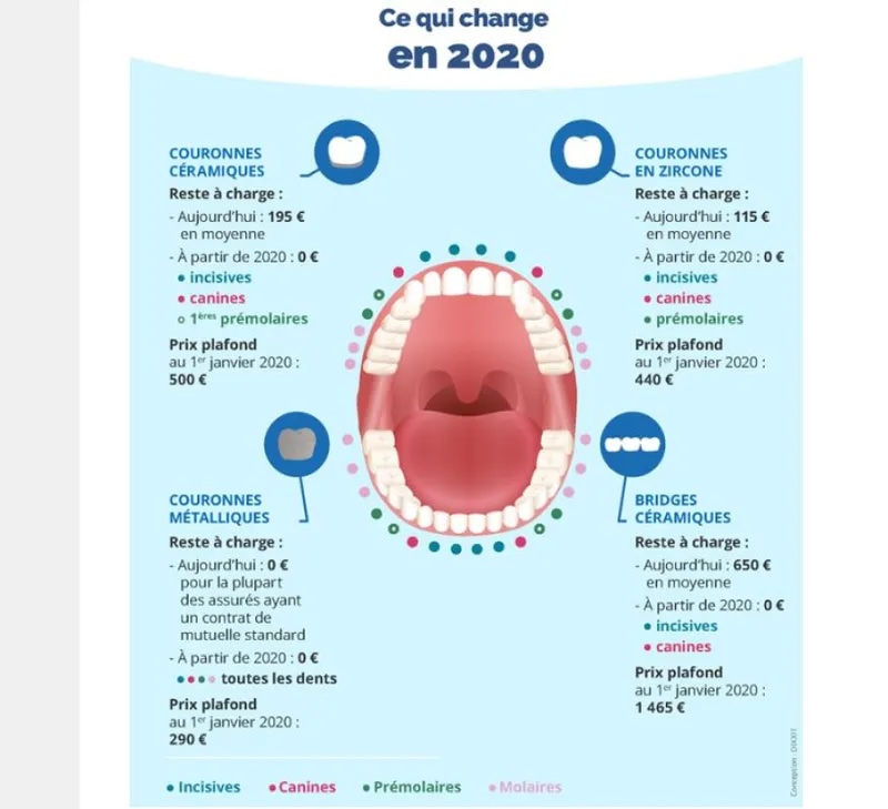 reste a charge dentaire