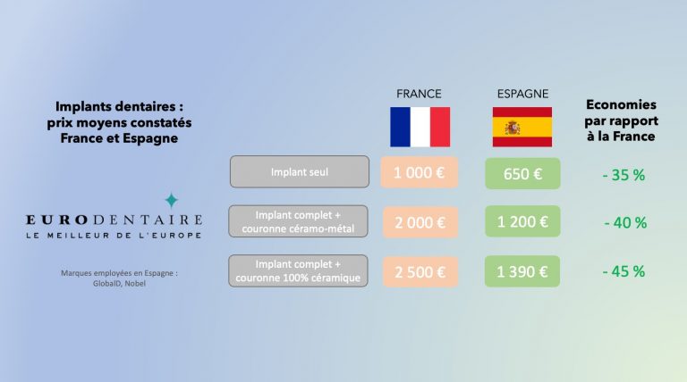 prix implants dentaires en espagne