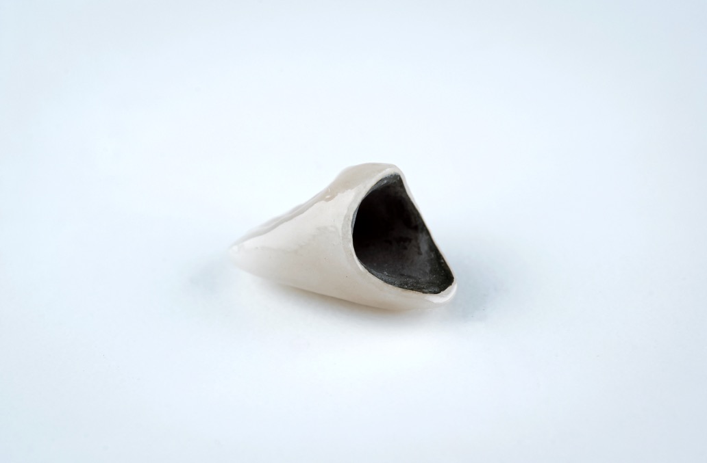 Couronne en céramo-métal sans implant