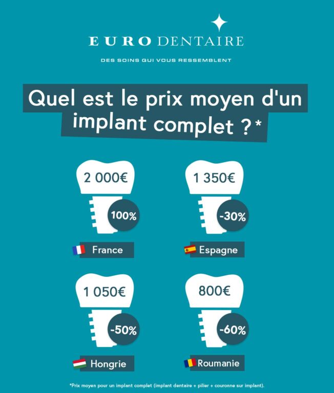 cout implant dentaire france VS etranger