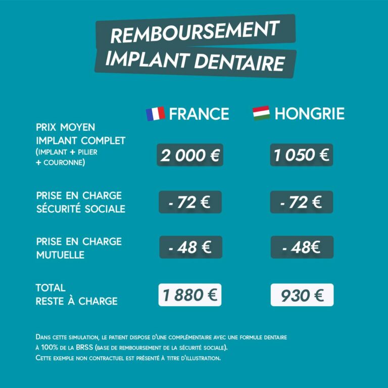comparatif remboursement implant dentaire