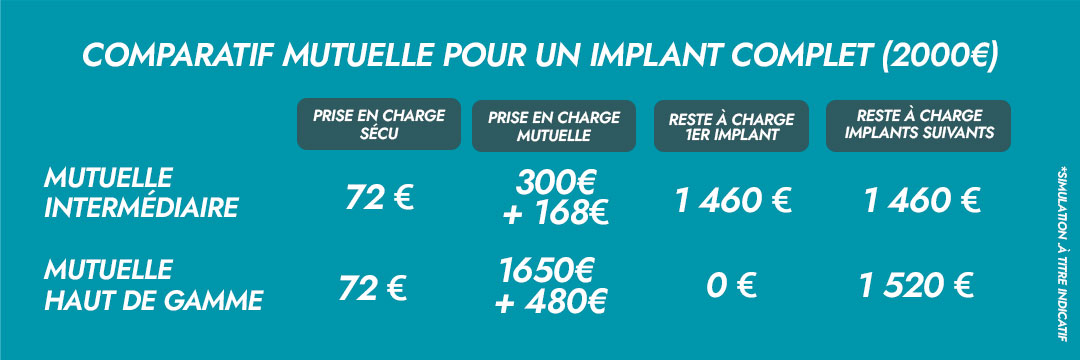 comparatif mutuelle pour un implant dentaire complet