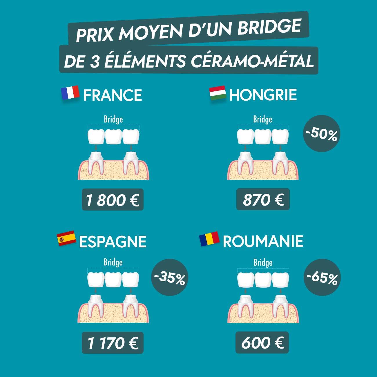Prix bridge ceramo metal