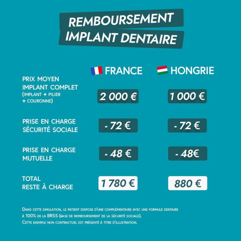 prix et remboursement des implants dentaires en hongrie