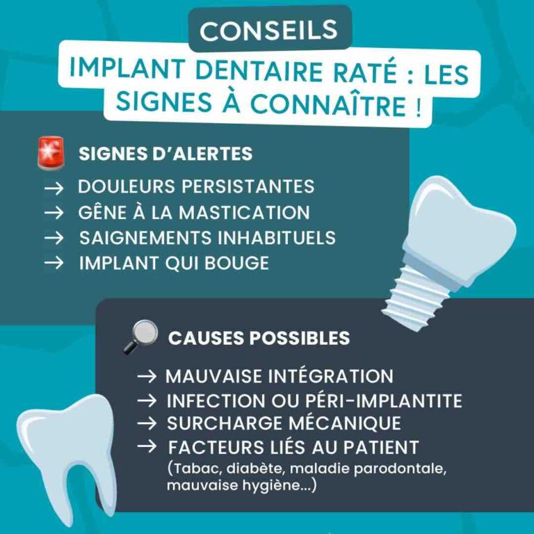 implant dentaire bouge